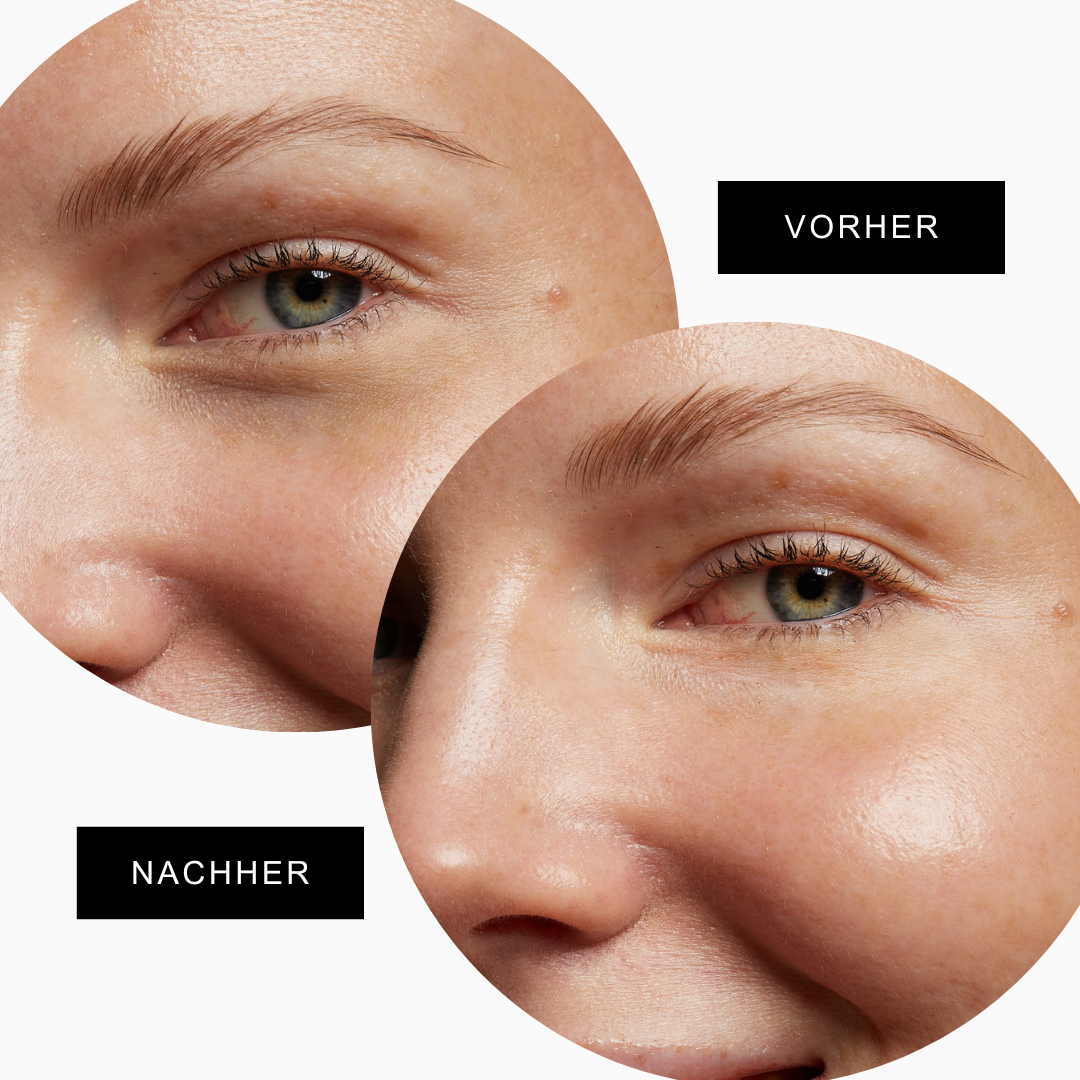 Everlasting Augenpads + Augenserum "Good day"